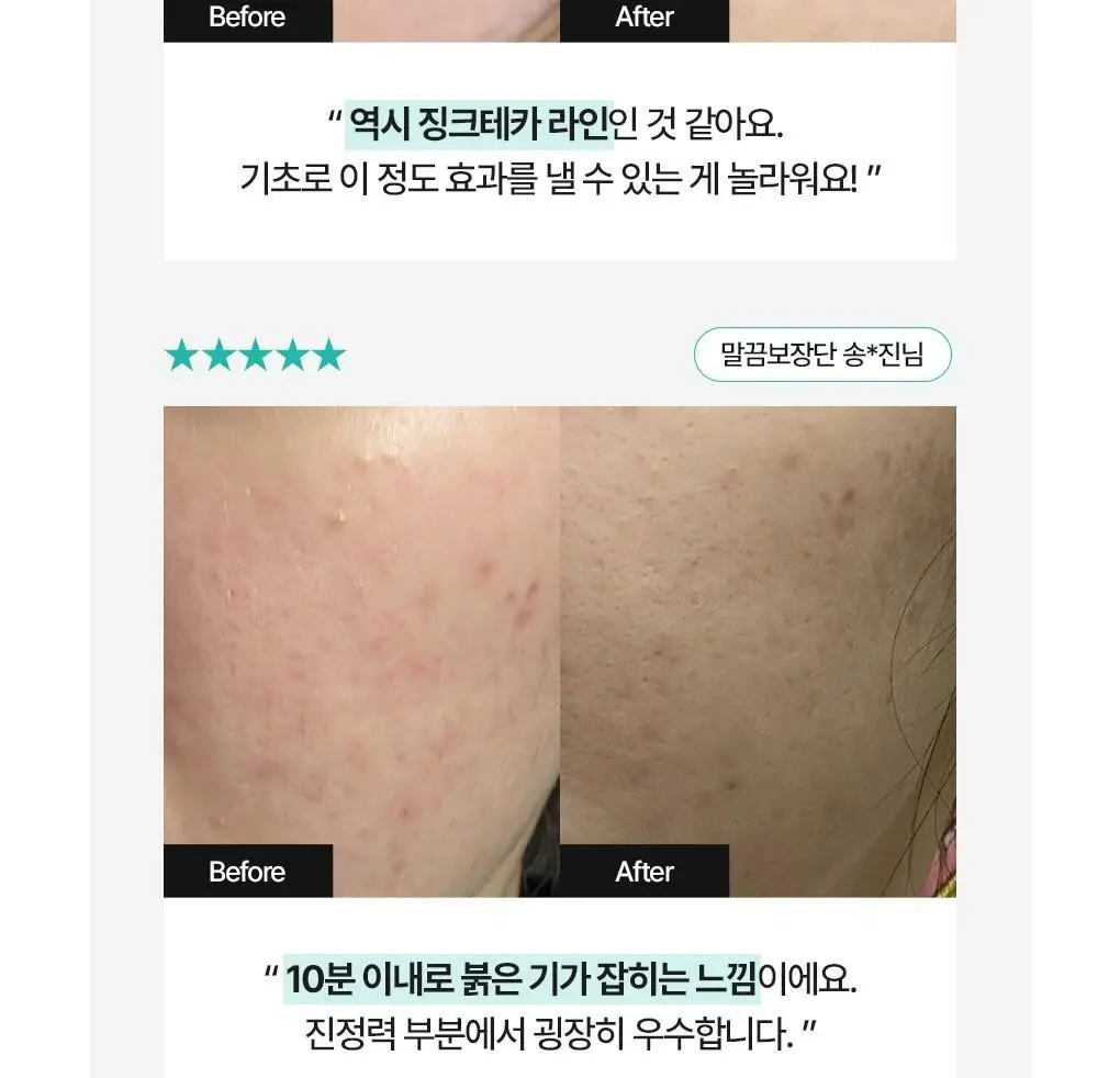 [가정의달특가] 브링그린 징크테카 리페어 흔적 크림 80ml (콜라보/기획) 상세페이지 11